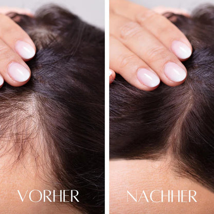 Hanna 3in1 Kopfhaut Massagebürste – für besseres Haarwachstum & eine entspannte Kopfhaut