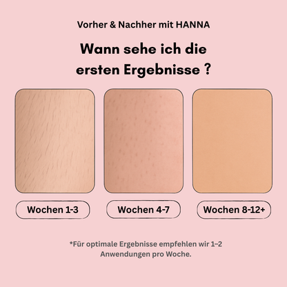 Hanna's IPL Hair Remover – Dauerhaft glatte Haut in 8 Wochen