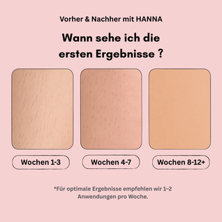 HANNA IPL Haarentferner – IPL-Gerät zur langfristigen Haarreduktion