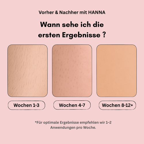 HANNA IPL Haarentferner – IPL-Gerät zur langfristigen Haarreduktion