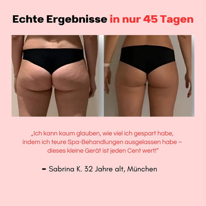 Hanna Sculpt – 3in1 Anti-Cellulite System