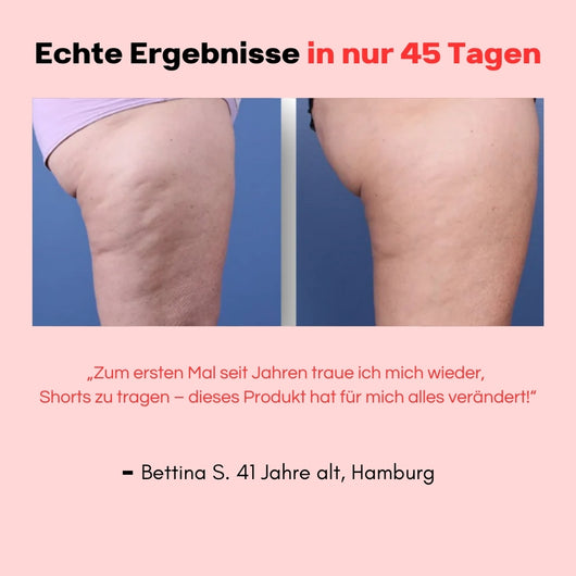 Hanna Sculpt – 3in1 Anti-Cellulite System