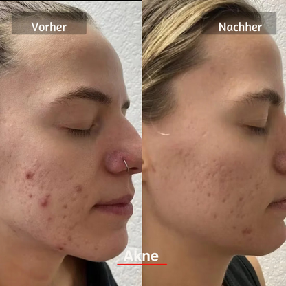 HANNA LED Face Mask PRO – Für glattere, straffere & sichtbar frischere Haut