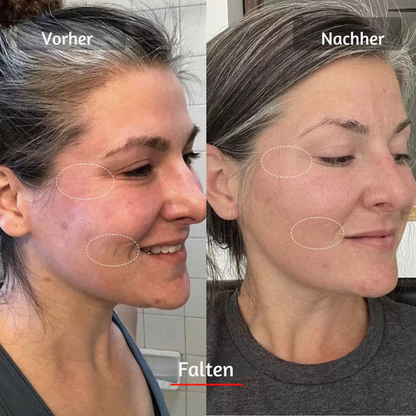 HANNA LED Face Mask PRO – Für glattere, straffere & sichtbar frischere Haut