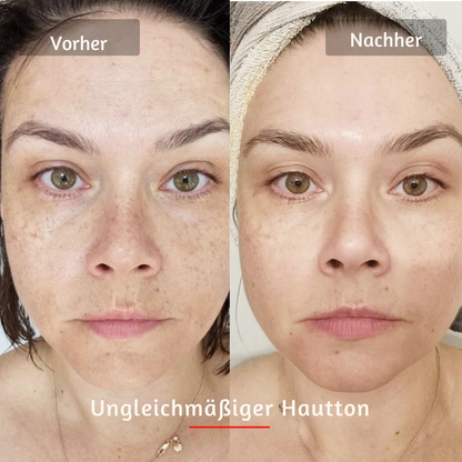 HANNA LED Face Mask PRO – Für glattere, straffere & sichtbar frischere Haut