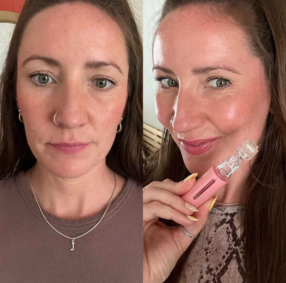 Hanna LipBoost Set – Naturally Fuller Lips Without Injections