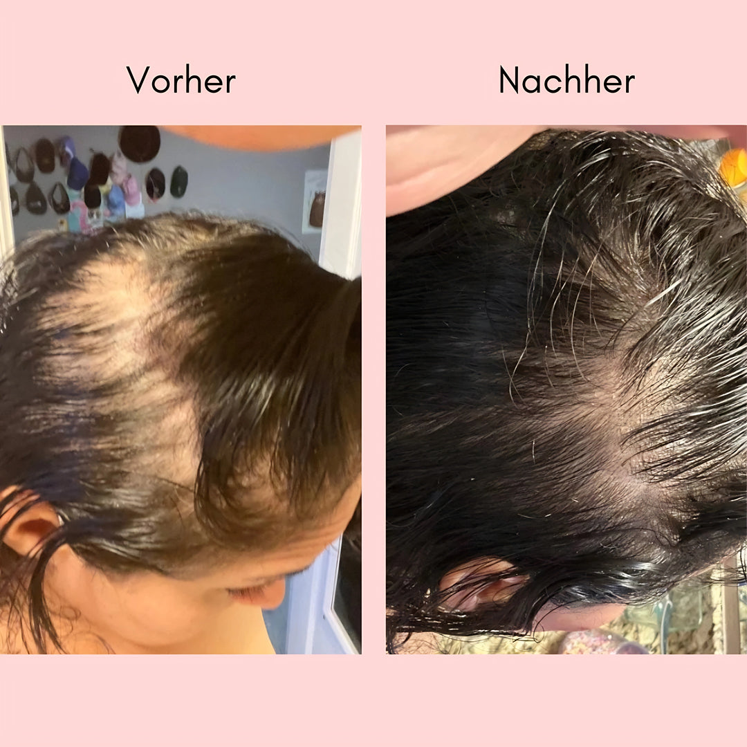 Hanna Elixir – Natürliches Haaröl gegen sichtbaren Haarausfall & dünner werdendes Haar