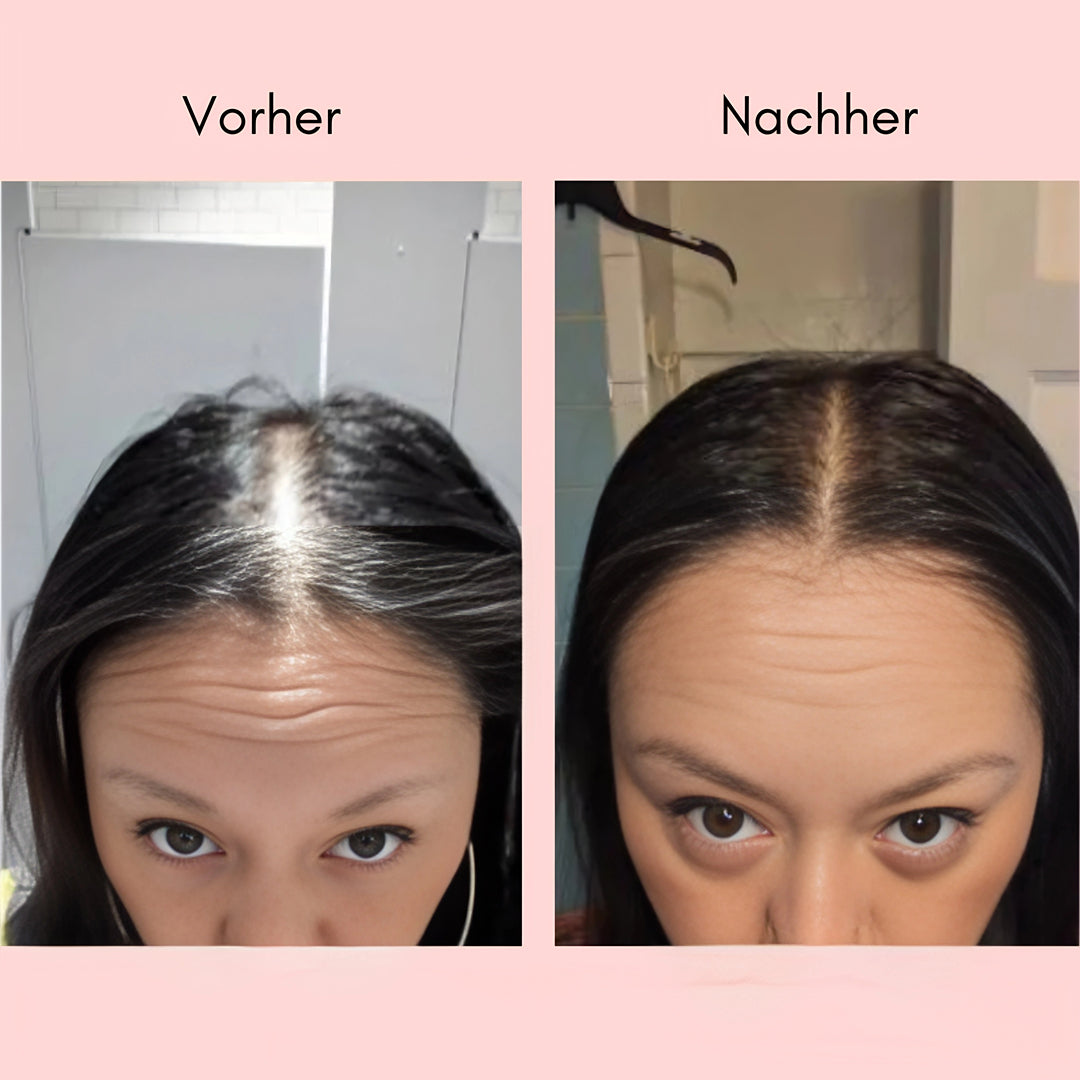 Hanna Elixir – Natürliches Haaröl gegen sichtbaren Haarausfall & dünner werdendes Haar