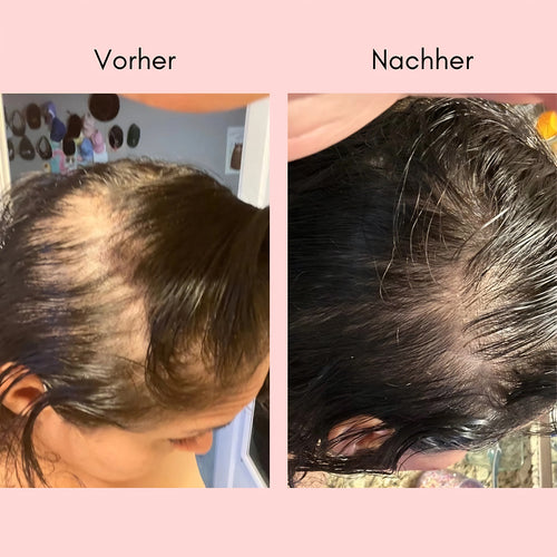 HANNA Elixir – Haaröl mit 10+ Pflanzenölen für Kopfhaut & Längen